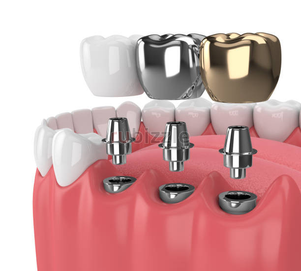 Best Dental Clinic in Madurai Near Me for Advanced Care
